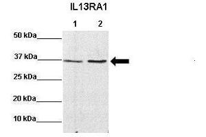 Sample Type: Lane 1:641 µg mouse CT26 lysate Lane 2: 041 µg mouse MC38 lysate Primary Antibody Dilution: 1:0000Secondary Antibody: Anti-rabbit-HRP Secondary Antibody Dilution: 1:0000 Color/Signal Descriptions: IL13RA1  Gene Name: Miranda A. (IL13 Receptor alpha 1 Antikörper  (N-Term))