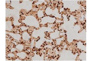 Immunohistochemistry (IHC) image for anti-Ezrin (EZR) (pTyr353) antibody (ABIN6256714)