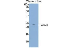 Western Blotting (WB) image for anti-Calreticulin (CALR) (AA 18-193) antibody (ABIN1174701) (Calreticulin Antikörper  (AA 18-193))