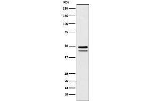 Western blot analysis of Brachyury expression in MUG-Chor1 (human sacral bone chordoma) cell lysate.
