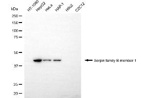 Western blotting analysis using serpin family B member 1 antibody (ABIN7800318).