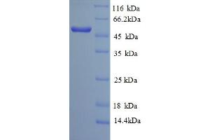 SDS-PAGE (SDS) image for Sialidase 3 (Membrane Sialidase) (Neu3) (AA 2-428) protein (His tag) (ABIN5713078)