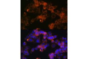 Immunofluorescence analysis of Hep G2 cells using Sonic Hedgehog (Shh) (Shh) Rabbit mAb (ABIN6131215, ABIN6147930, ABIN6147931 and ABIN7101409) at dilution of 1:100 (40x lens). (Sonic Hedgehog Antikörper)