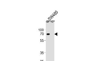 Western blot analysis of ETV5 Antibody (N-term) Pab (ABIN654690 and ABIN2844382) pre-incubated without(lane 1) and with(lane 2) blocking peptide in S cell line lysate. (ETV5 Antikörper  (N-Term))