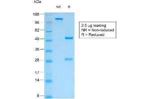 SDS-PAGE Analysis of Purified pan-IgG Mouse Recombinant Monoclonal Antibody ABIN6383781.
