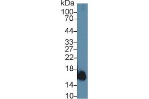 Myoglobin Antikörper  (AA 1-154)