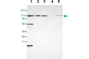 Western blot analysis of Lane 1: RT-4, Lane 2: U-251 MG, Lane 3: A-431, Lane 4: Liver, Lane 5: Tonsil with INTS6 polyclonal antibody at 1:250 - 1:500 dilution.