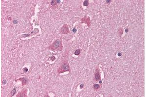 Human Brain, Cortex (formalin-fixed, paraffin-embedded) stained with HSF1 antibody ABIN214116 at 5 ug/ml followed by biotinylated goat anti-rabbit IgG secondary antibody ABIN481713, alkaline phosphatase-streptavidin and chromogen. (HSF1 Antikörper  (C-Term))