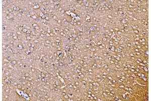 IHC analysis of SYP using anti-SYP antibody (ABIN7603120). (Synaptophysin Antikörper  (N-Term))