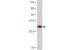 Western Blot detection against Immunogen (37 KDa) . (PINX1 Antikörper  (AA 1-100))