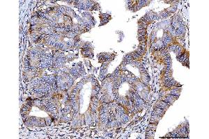 IHC analysis of Poliovirus Receptor/PVR using anti-Poliovirus Receptor/PVR antibody (ABIN7601072). (Poliovirus Receptor Antikörper  (AA 28-331))
