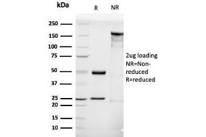 SDS-PAGE Analysis Purified LHCGR Mouse Monoclonal Antibody (LHCGR/1416). (LHCGR Antikörper  (AA 70-410))