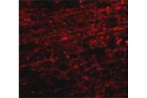Immunofluorescence staining of human brain tissue with 20 ug/mL CLIP1 polyclonal antibody . (CLIP1 Antikörper  (C-Term))