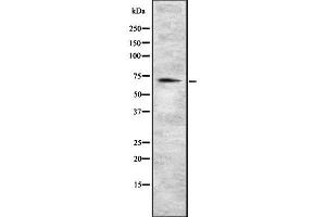 Western blot analysis of EOMES using HuvEc whole cell lysates (EOMES Antikörper  (C-Term))