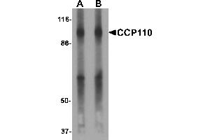 Western blot analysis of CCP110 in human colon tissue lysate with CCP110 antibody at (A) 1 and (B) 2 µg/mL. (CP110 Antikörper  (C-Term))