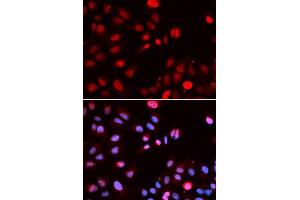 Immunofluorescence analysis of U2OS cells using MPG antibody. (MPG Antikörper  (AA 1-293))
