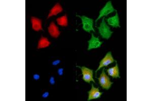 ABIN6258170 and ABIN6273862 staining  cells by IF/ICC. (GPR22 Antikörper  (N-Term))