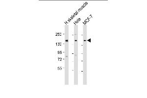 All lanes : Anti-TNRC6A Antibody (Center) at 1:1000-1:2000 dilution Lane 1: human skeletal muscle lysate Lane 2: Hela whole cell lysate Lane 3: MCF-7 whole cell lysate Lysates/proteins at 20 μg per lane. (TNRC6A Antikörper  (AA 855-885))