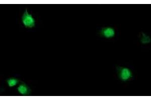 Anti-SDS mouse monoclonal antibody (ABIN2455307) immunofluorescent staining of COS7 cells transiently transfected by pCMV6-ENTRY SDS (RC217814). (serine Dehydratase Antikörper)