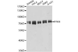 Western blot analysis of extracts of various cell lines, using PAK4 antibody (ABIN5998444) at 1/5000 dilution. (PAK4 Antikörper)