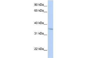 WB Suggested Anti-FHL3 Antibody Titration:  0. (FHL3 Antikörper  (Middle Region))