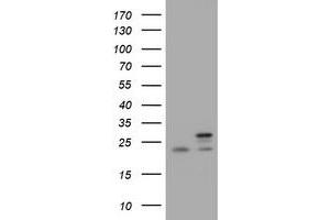 Image no. 3 for anti-NADH Dehydrogenase (Ubiquinone) 1 beta Subcomplex, 10, 22kDa (NDUFB10) antibody (ABIN1499673) (NDUFB10 Antikörper)