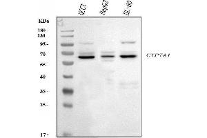 Western blot analysis of CYP7A1 using anti-CYP7A1 antibody (ABIN7599604).
