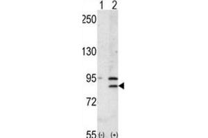 Western Blotting (WB) image for anti-Bromodomain Containing 2 (BRD2) antibody (ABIN3003651)