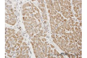 Immunoperoxidase of monoclonal antibody to TNNI3 on formalin-fixed paraffin-embedded human heart. (TNNI3 Antikörper  (AA 102-210))