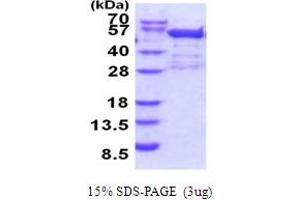 SDS-PAGE (SDS) image for Bromodomain Containing 2 (BRD2) (AA 1-455) protein (His tag) (ABIN5853962)