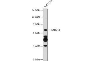 Western blot analysis of extracts of Rat brain, using G antibody (ABIN6135078, ABIN6140946, ABIN7101653 and ABIN7101654) at 1:500 dilution. (GALNT4 Antikörper)