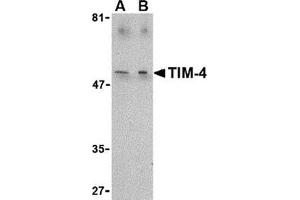 Western blot analysis of TIM-4 in Jurkat lysate with this product at (A) 1 and (B) 2 μg/ml. (TIMD4 Antikörper  (C-Term))