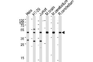 Western Blotting (WB) image for anti-Glutamate-Ammonia Ligase (GLUL) (AA 70-96), (N-Term) antibody (ABIN390879)
