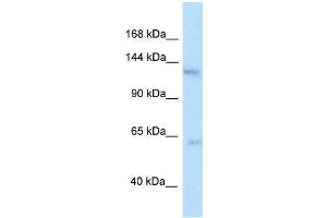 Western Blot showing Ttbk2 antibody used at a concentration of 1. (TTBK2 Antikörper  (N-Term))