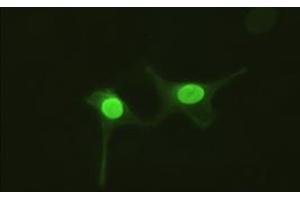 Anti-AK1 mouse monoclonal antibody (AK1) immunofluorescent staining of HeLa cells transiently transfected by pCMV6-ENTRY AK1 (RC215130). (Adenylate Kinase 1 Antikörper)