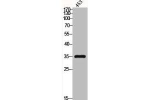 Western Blot analysis of 453 cells using C/EBP ε Polyclonal Antibody (CEBPE Antikörper)