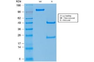SDS-PAGE Analysis of Purified TP53 Mouse Recombinant Monoclonal Antibody ABIN6383817. (Rekombinanter p53 Antikörper)