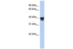 NAPE-PLD antibody used at 1 ug/ml to detect target protein. (NAPEPLD Antikörper  (N-Term))