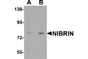 Western blot analysis of NIBRIN in rat lung tissue lysate with NIBRIN antibody at (A) 1 and (B) 2 µg/mL. (Nibrin Antikörper  (N-Term))