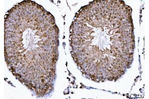 IHC analysis of CSNK2K2 using anti-CSNK2K2 antibody (ABIN7602871). (CSNK2A2 Antikörper  (C-Term))