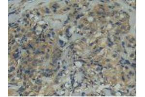 Figure. (ITGAD Antikörper  (AA 879-1099))