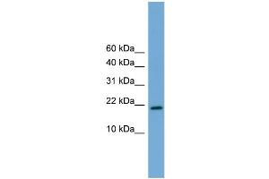 WB Suggested Anti-Cited4 Antibody Titration:  0. (CITED4 Antikörper  (Middle Region))