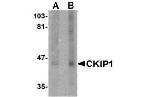 Western blot analysis of CKIP1 in human lung tissue lysate with AP30235PU-N CKIP1 antibody at (A) 1 and (B) 2 μg/ml. (PLEKHO1 Antikörper  (C-Term))