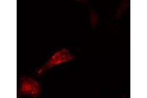 ABIN6276576 staining  HeLa cells by IF/ICC.