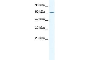 WB Suggested Anti-ZNF21 Antibody Titration:  0. (ZNF182 Antikörper  (Middle Region))