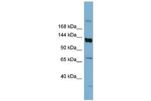 WB Suggested Anti-ABCB4  Antibody Titration: 0. (ABCB4 Antikörper  (Middle Region))