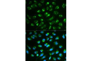 Immunofluorescence analysis of MCF7 cell using IL7 antibody. (IL-7 Antikörper  (AA 26-177))