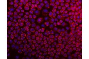 IF analysis of DARS2 using anti-DARS2 antibody (ABIN6719279). (DARS2 Antikörper  (AA 334-448))