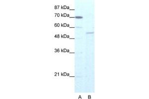 Western Blotting (WB) image for anti-Zinc Finger Protein 665 (ZNF665) antibody (ABIN2461274) (ZNF665 Antikörper)