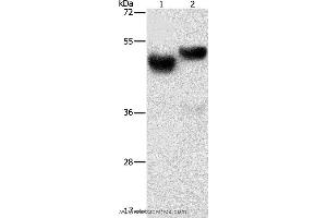 Western blot analysis of Human fetal brain and liver tissue, using AMZ1 Polyclonal Antibody at dilution of 1:1000 (AMZ1 Antikörper)